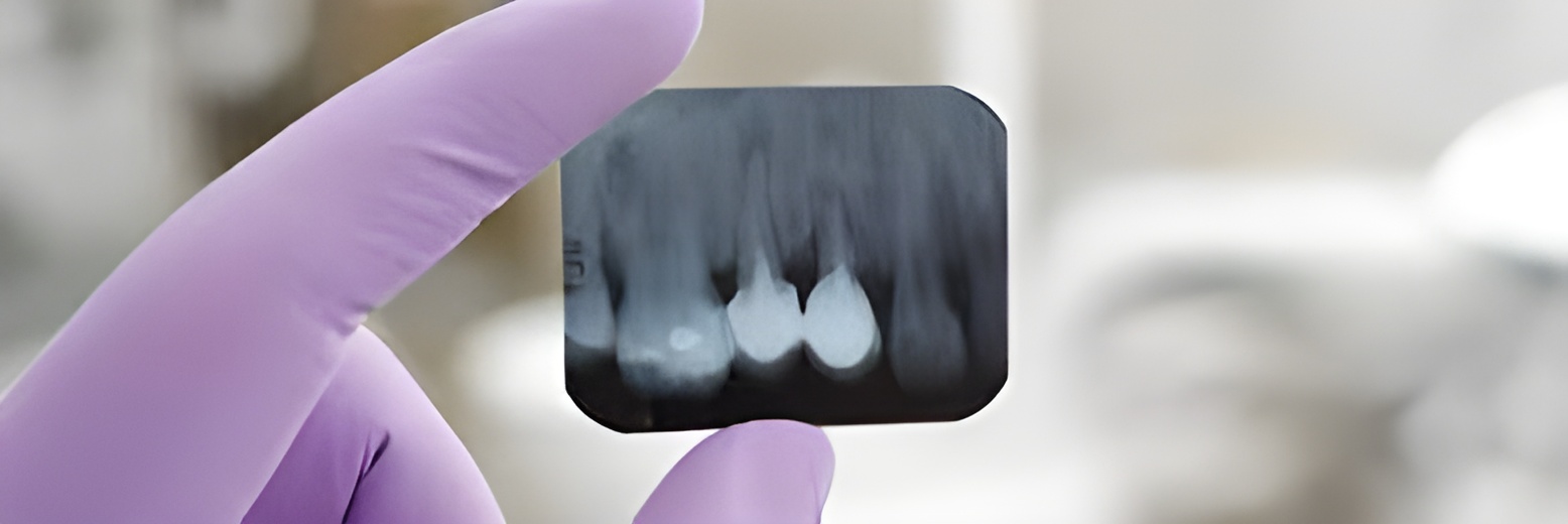 Imagerie en odontologie S5 