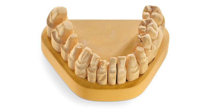 Matériaux de restauration et de réplique 